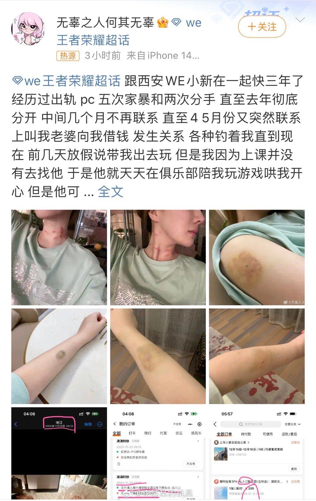 #小新被爆家暴出轨#好像是电竞圈第一个家暴事件[开学季] ​​​