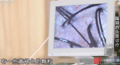浙江宁波，男子去理头发，结果去洗了个头，花了 6 万元，店员跟他说，他的头皮上长