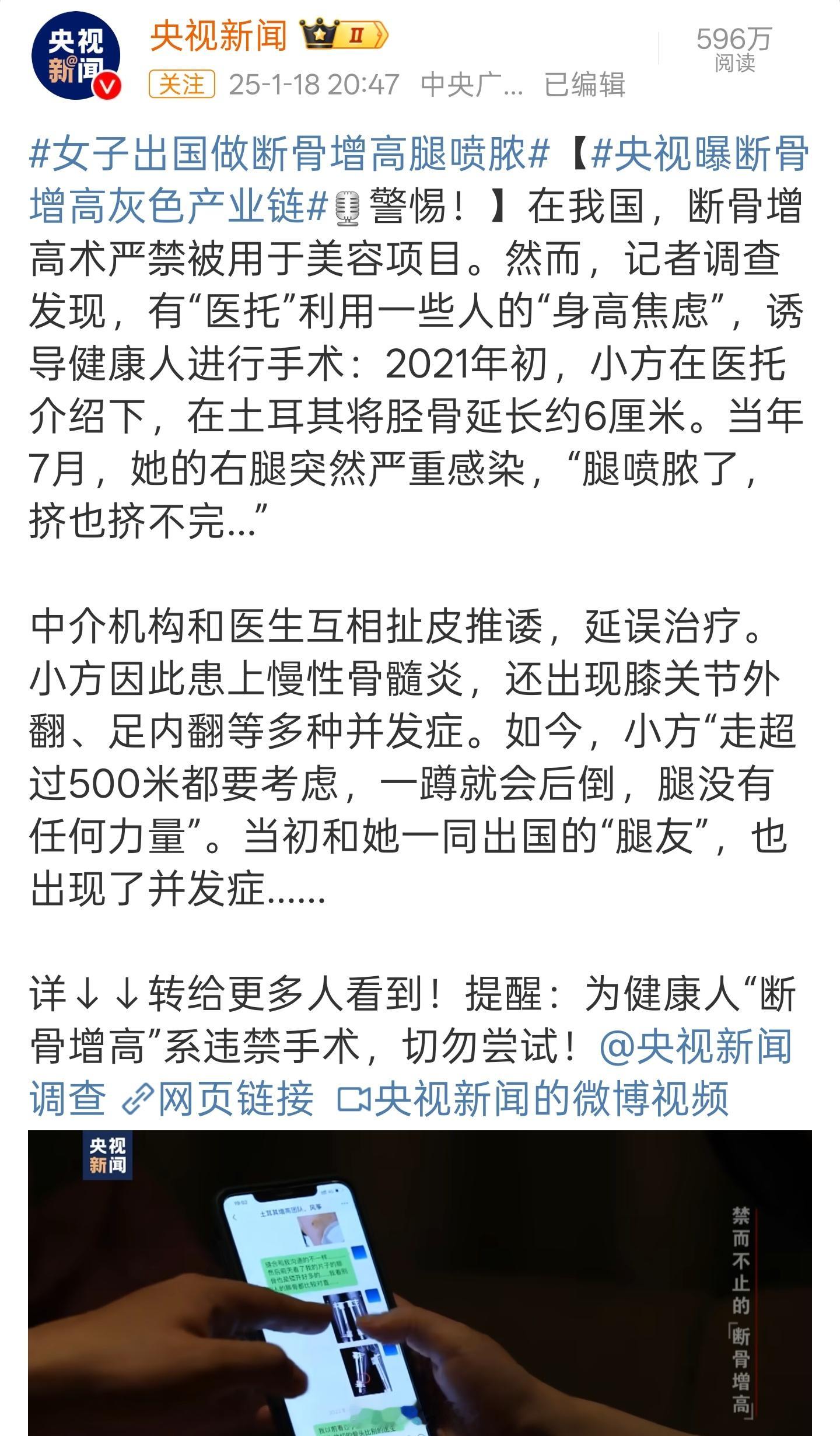 央视曝断骨增高灰色产业链 断骨增高6cm，还真的有人敢做啊颠覆我的三观了最后出现