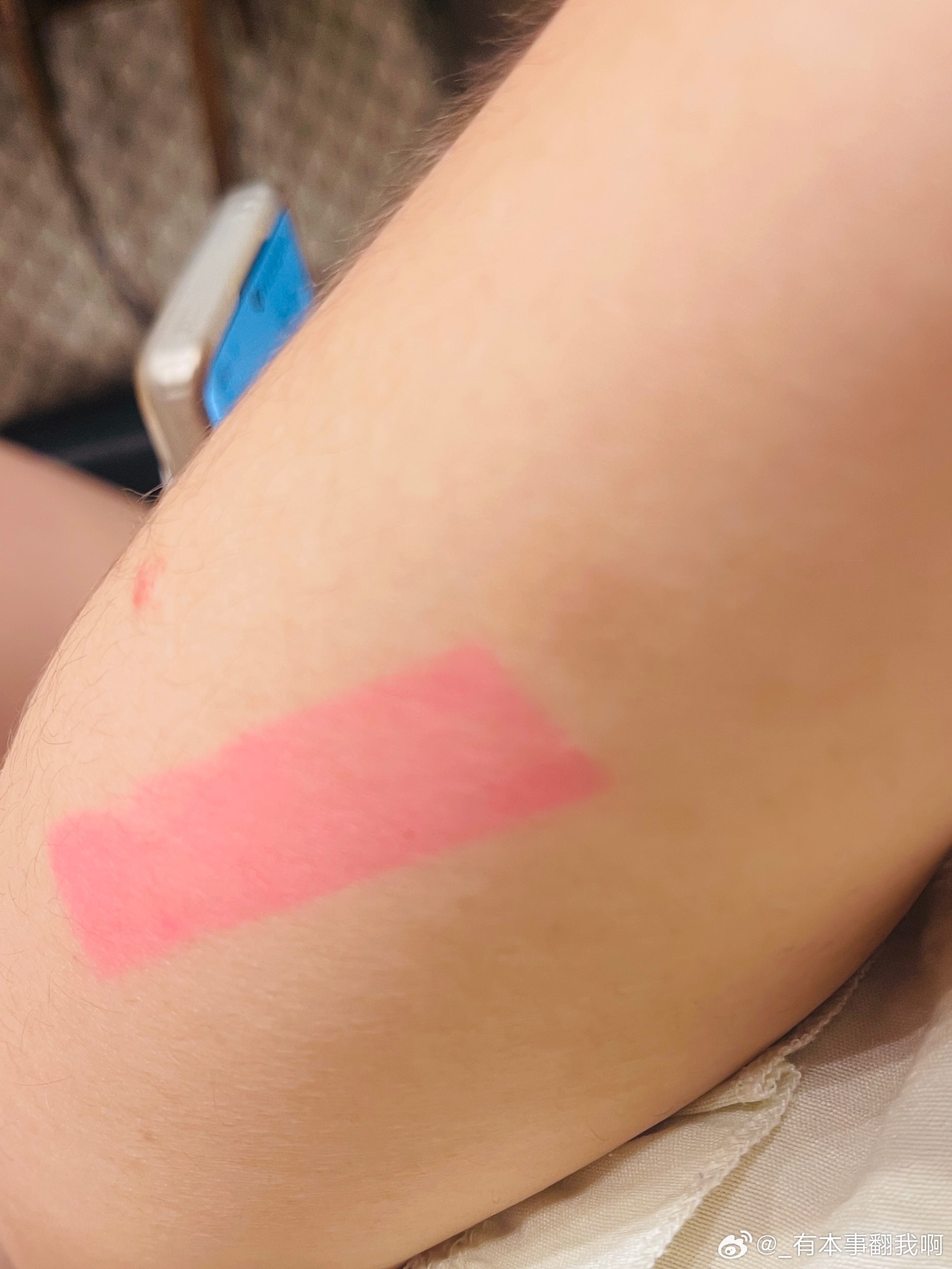 腰酸背痛，还被染色了