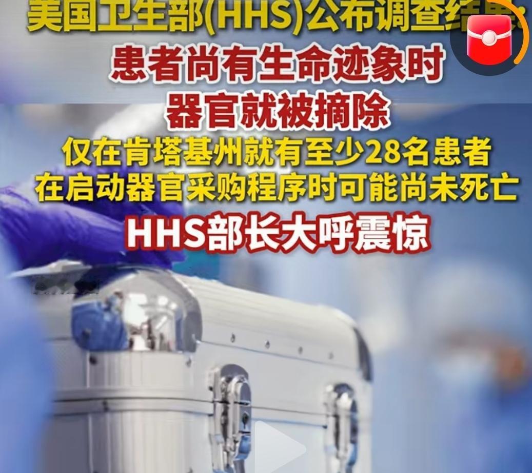 说个有点儿狗血的新闻
美联社8日6日报道:特朗普政府宣布关停了肯塔基州的一个捐赠