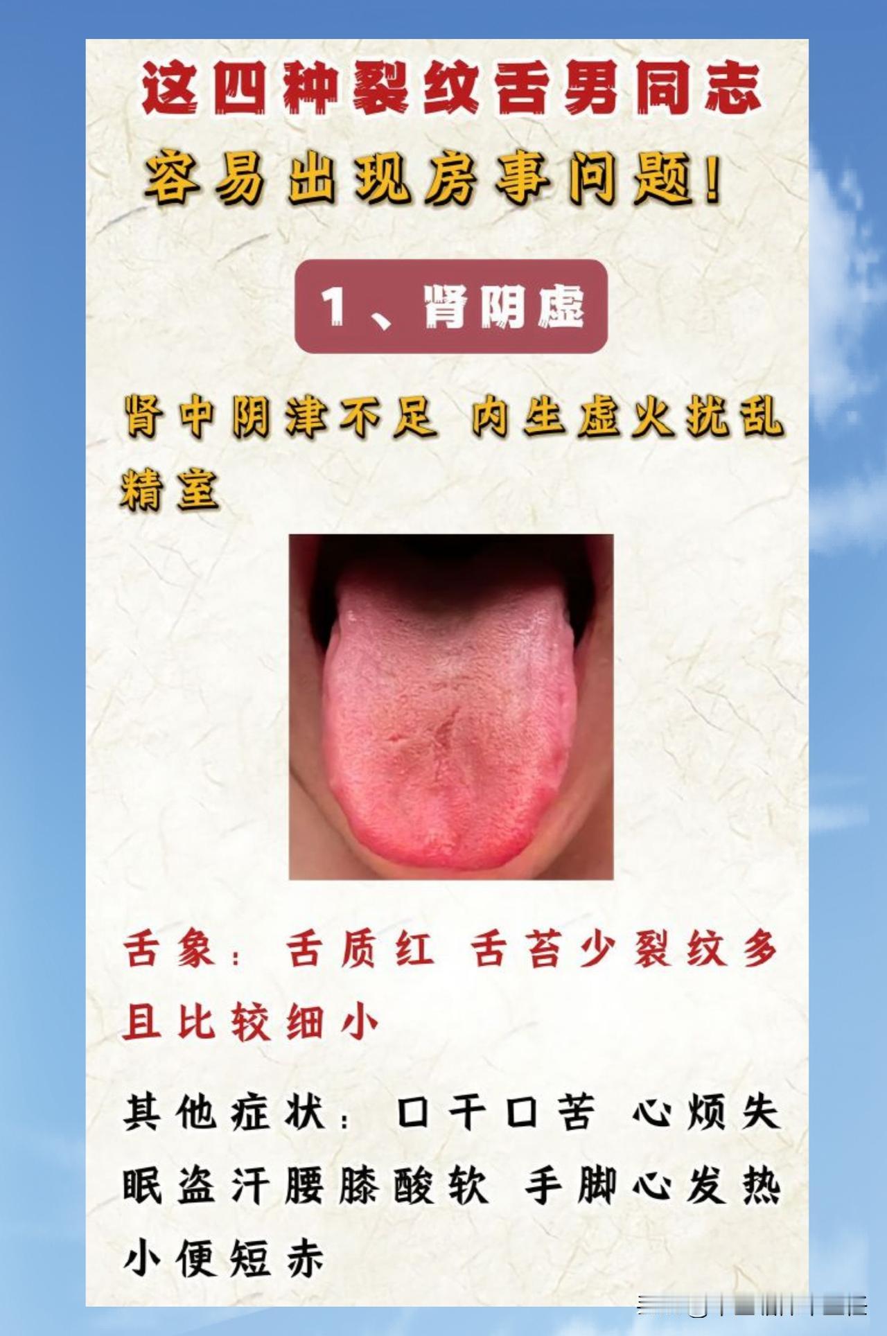 男人舌面出现裂纹，小心房事出现问题！

以下四种裂纹舌，看看你是哪一种？

一：