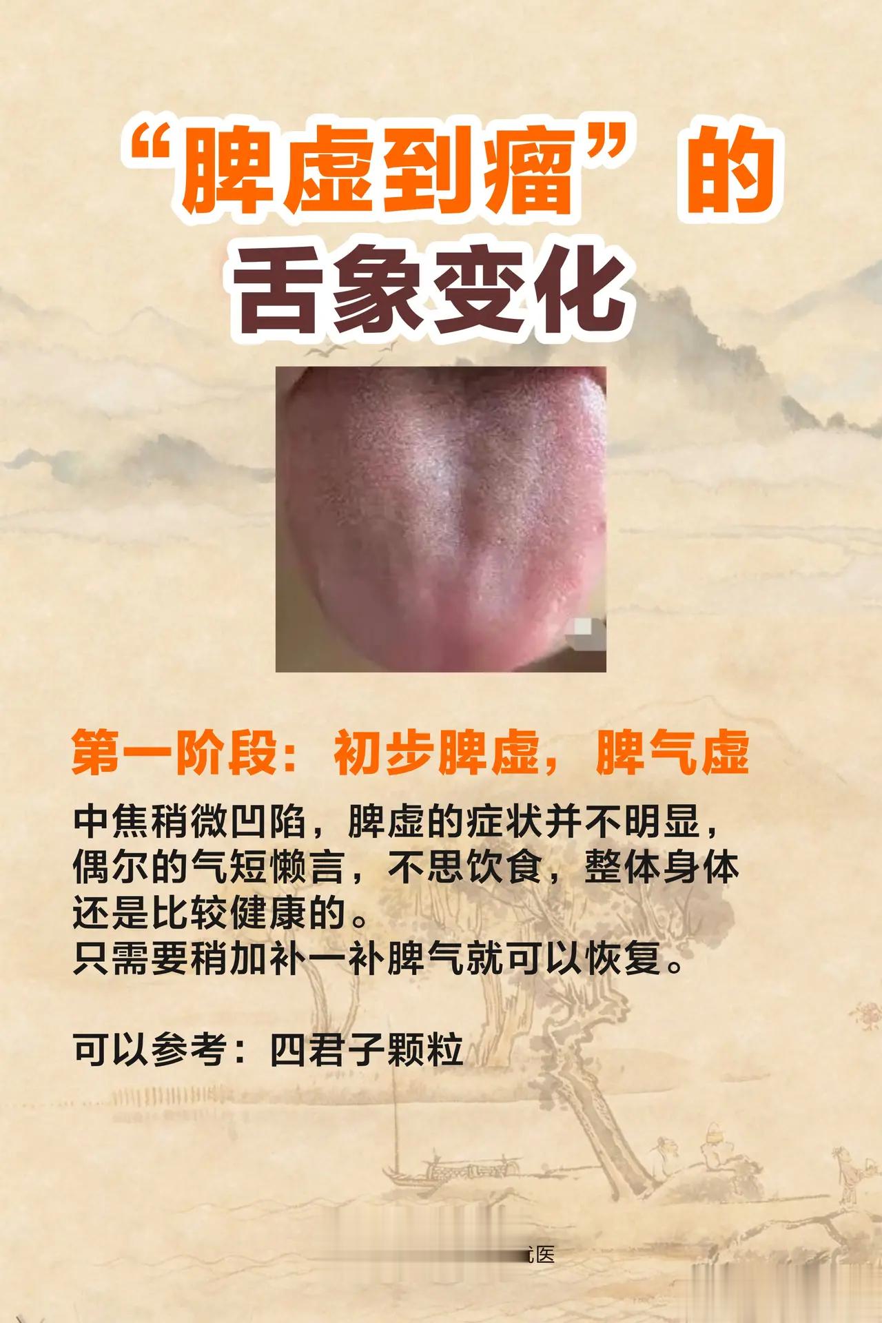 从脾虚到瘤经历的6个阶段:虚一寒一湿一滞一瘀一闭！第一阶段:从强到虚气血调和,百