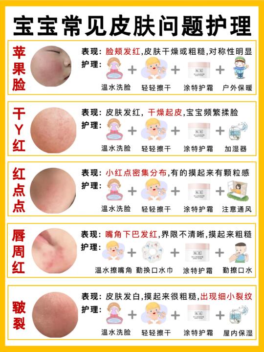 🚫别乱涂！敏宝皮肤问题自救攻略！