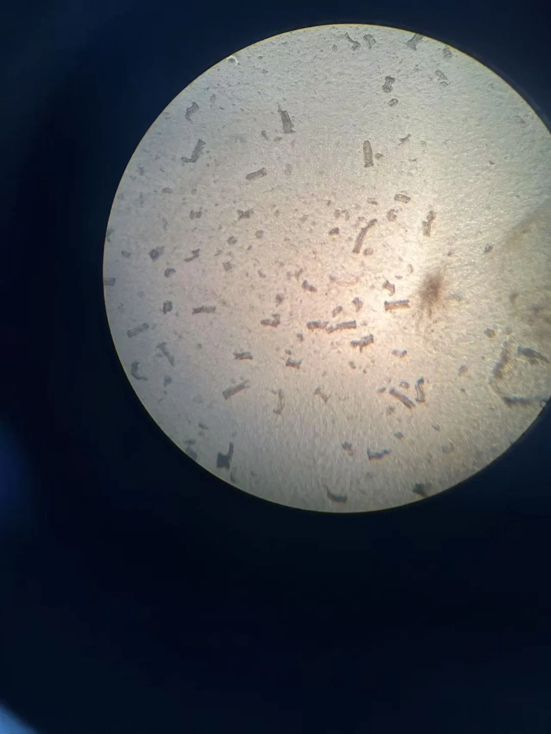 人结肠类器官长得忒快了