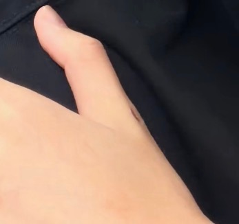 看上去很深一道伤口呀tt 
