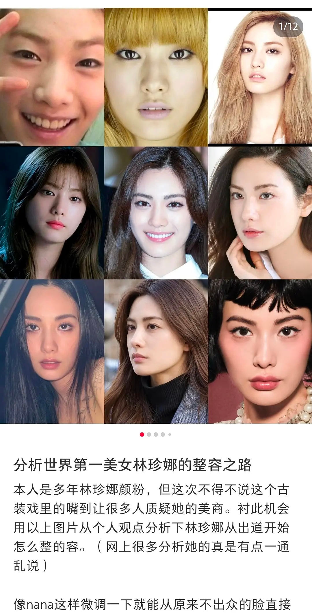 林珍娜从原生脸到现在，到底算不算大整？ ​​​