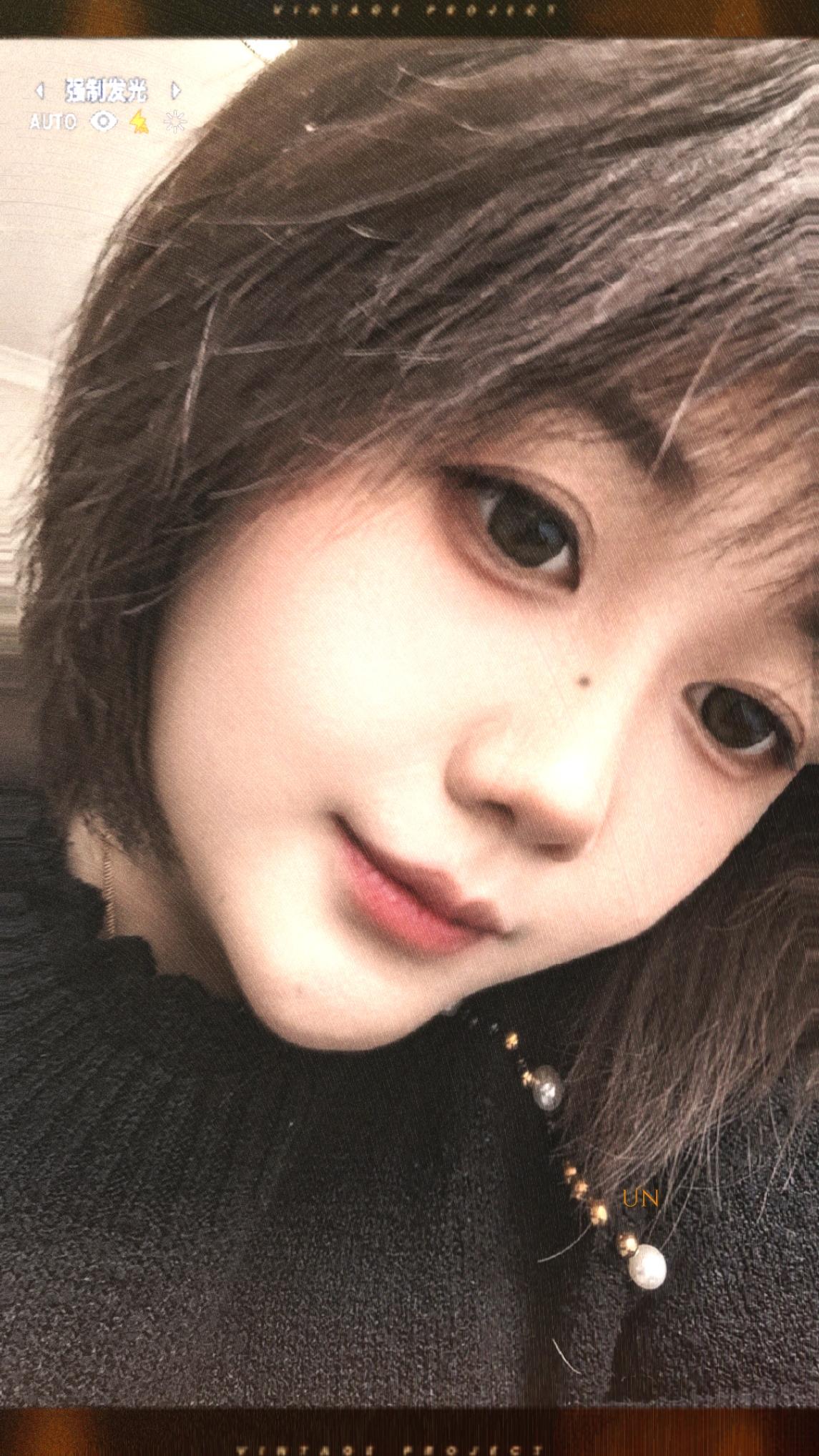 塞翁失马焉知非福，无痛减肥😉