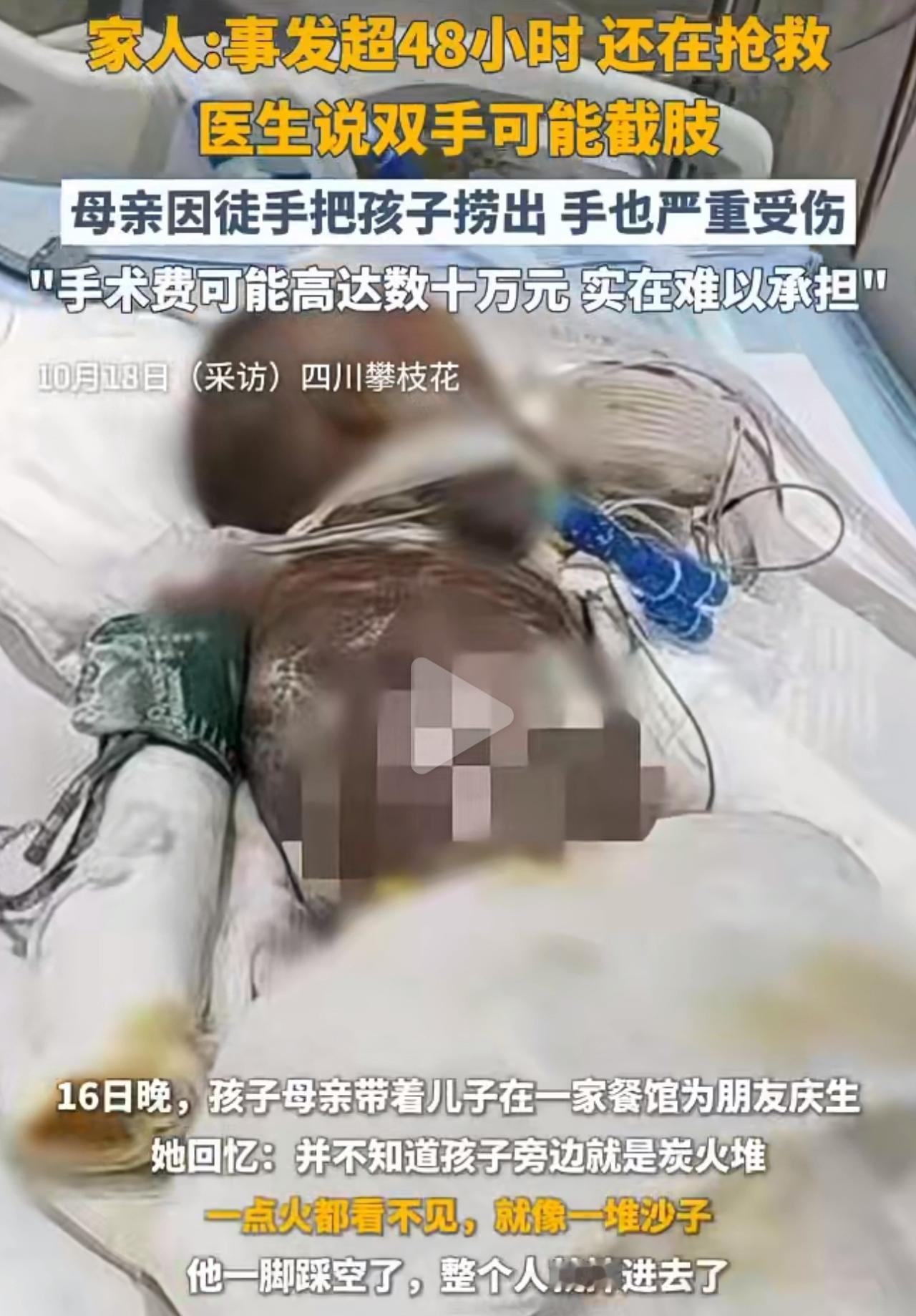 3岁娃一脚踩进烧烤店的“沙堆”，妈妈伸手去拉，手上的皮瞬间就掉了——谁能料到啊，
