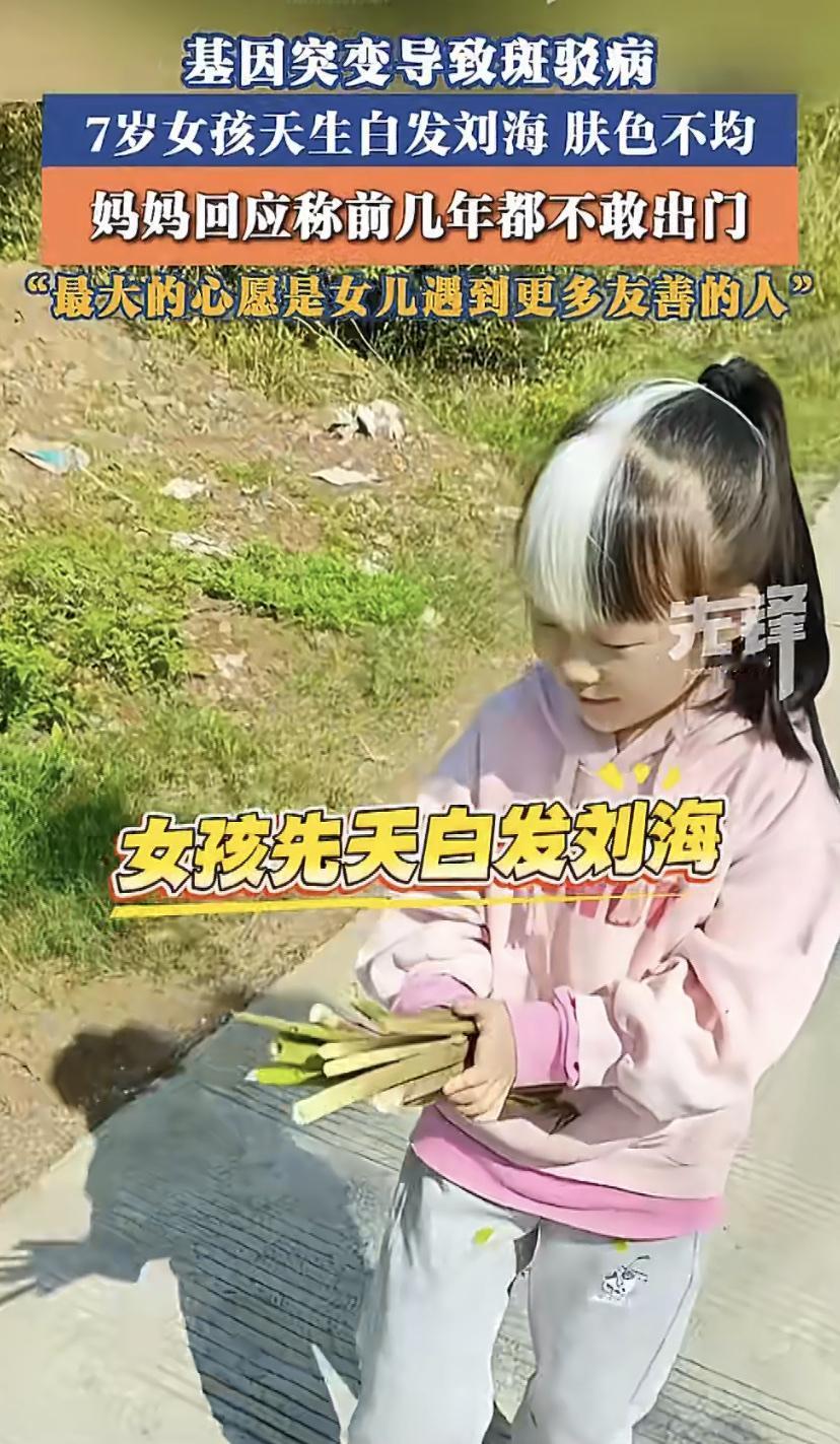 湖南邵阳有个7岁小女孩，天生刘海是白色的，最近在网上火了。
其实她出生就被确诊罕