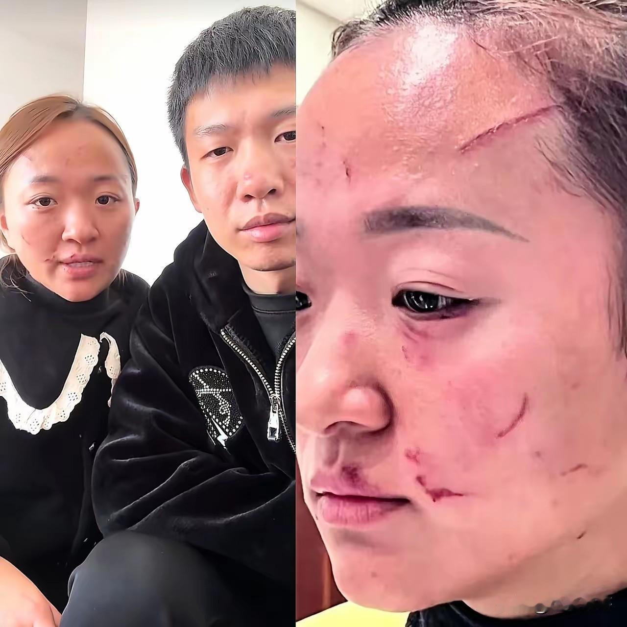 37岁的王某给所有女人提了个醒

不是因为和婆婆争执对错，也不是计较带孩子辛苦，