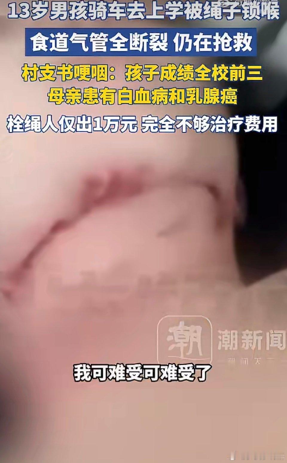 触目惊心！老人私拉绳子，致男孩气管全断裂，安全隐患不容忽视
 
一则让人揪心的意