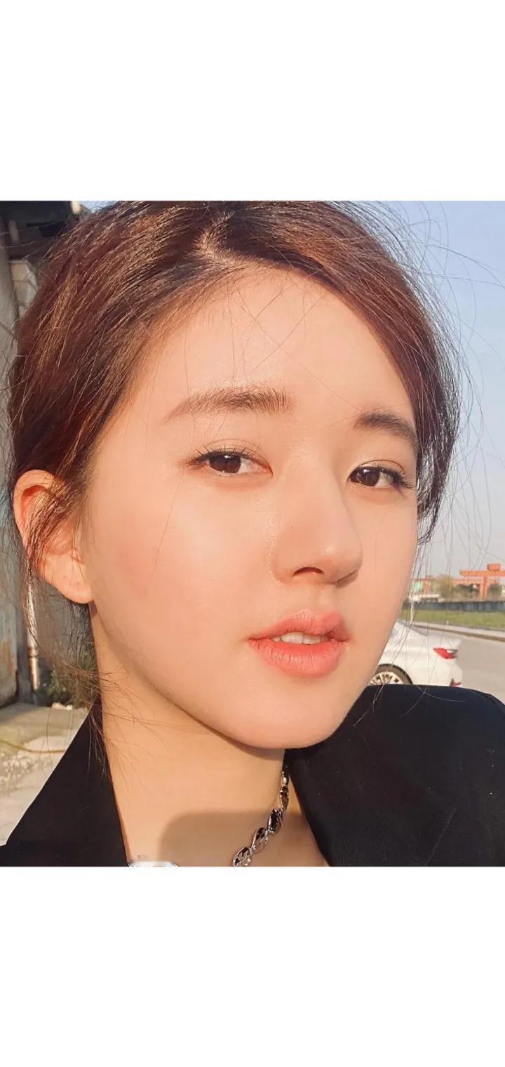 赵露思面部微调之路：追求完美，不惧挑战

赵露思，一个在演艺圈内备受瞩目的名字，