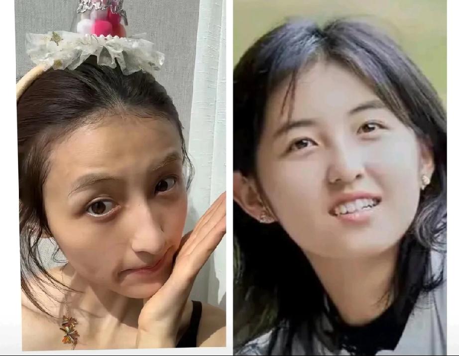 张子枫，
听我一句劝！
你可以去伊美，也可以整容，但是千万千万不要再过度节食减重