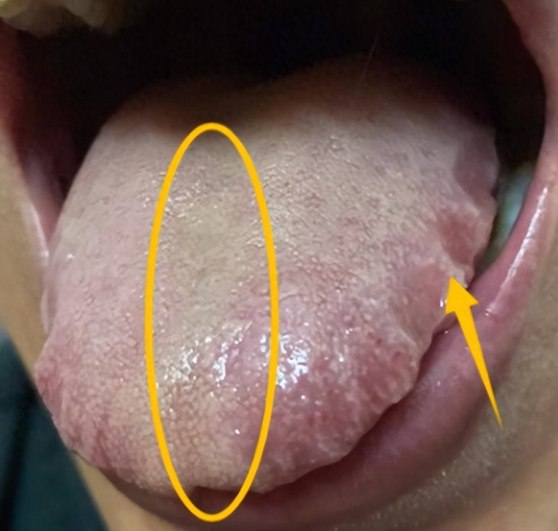 30秒都难坚持的舌象长啥样，不管是男女，都有必要知道了解一下！

很多朋友来面诊