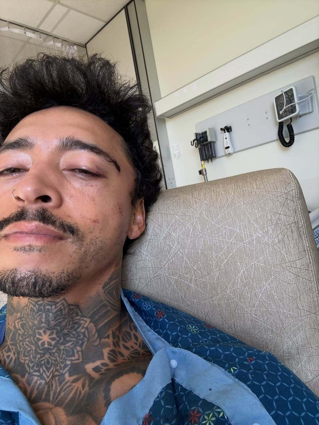 Nyjah Huston 日前在社交媒体透露，自己再次遭遇严重伤病。目前确认伤势