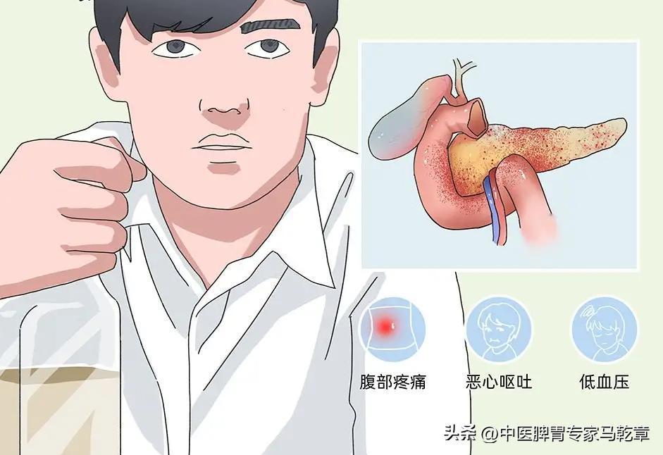 胰腺炎都有什么症状？
胰腺炎症状包括以下几个方面：
1、轻度胰腺炎：一般以腹痛、