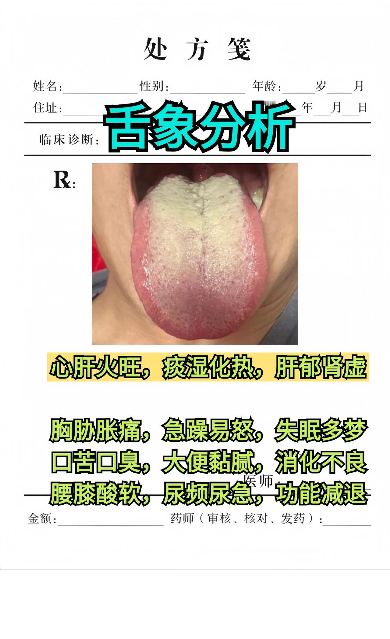 继续舌诊分析，第25天，还是老样子，你发我看！
#中医##健康#