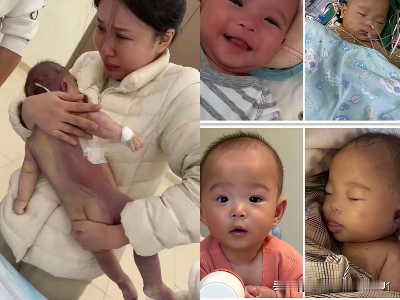 五个月大的宝宝洛熙被查出卵圆孔未闭，因医生强烈建议手术，家长出于对医生的信任同意