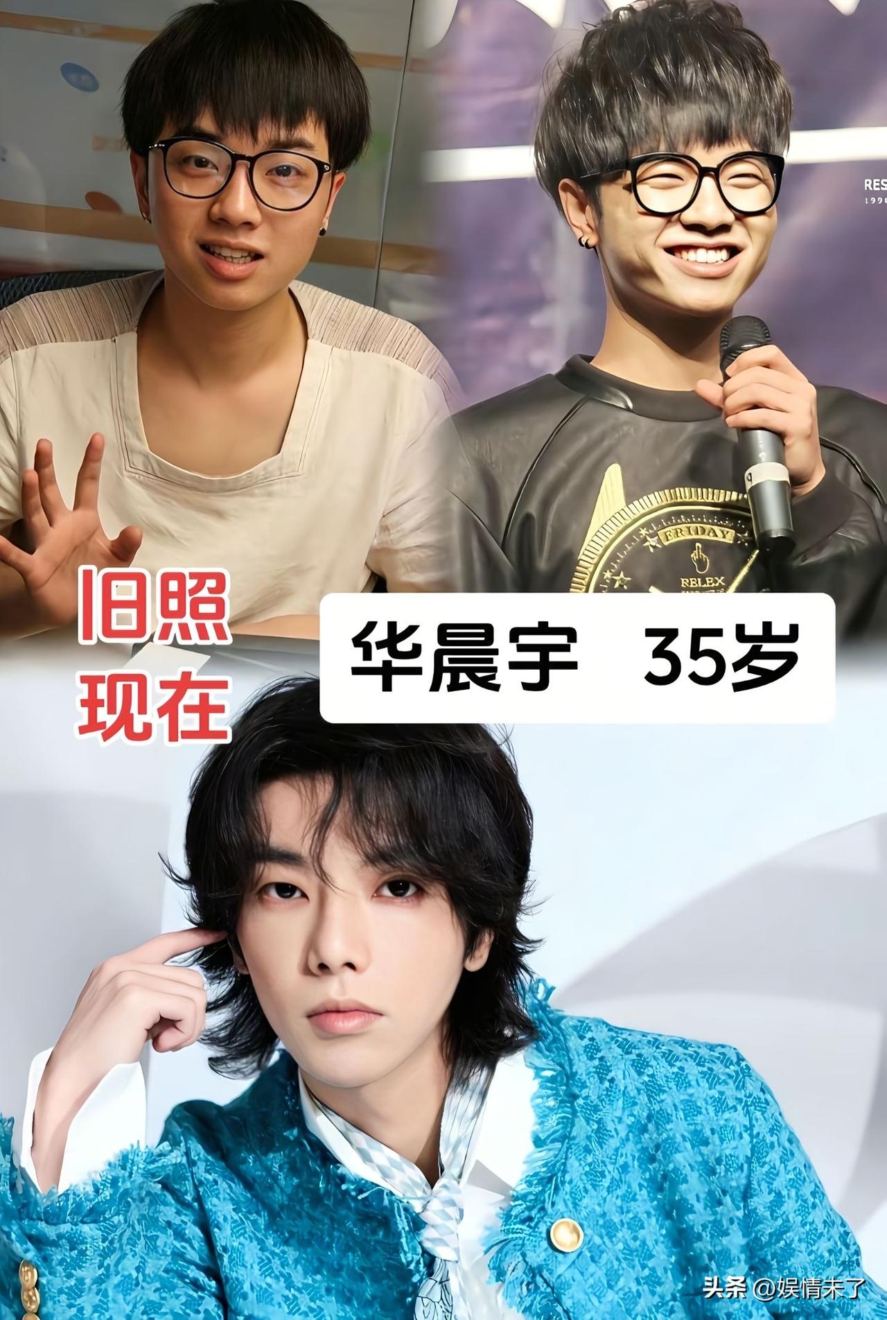 都说红气养人，看明星出道前后的对比就知道了。人气上来之后，整个人的气质、状态和颜