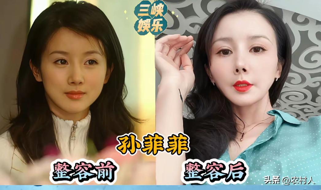 整容过度的9位女明星，虽然说爱美之心人皆有之，但是也不能过度整容。你们觉得哪一个