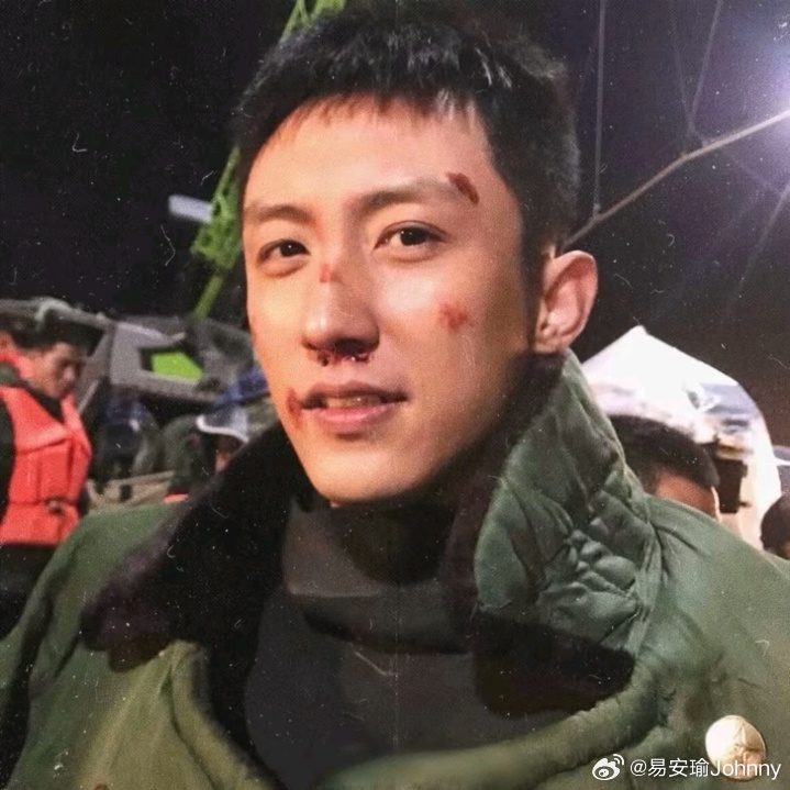 虎牙（咬合不齐），大咬肌，易敏感肤质，容易泛红的脸颊，总是睡不够的倦容和半永久黑