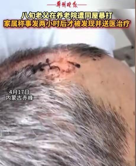 4月17日，内蒙古赤峰一家挂着“全方位安全保障”金字招牌的康养院里，扯下了养老产