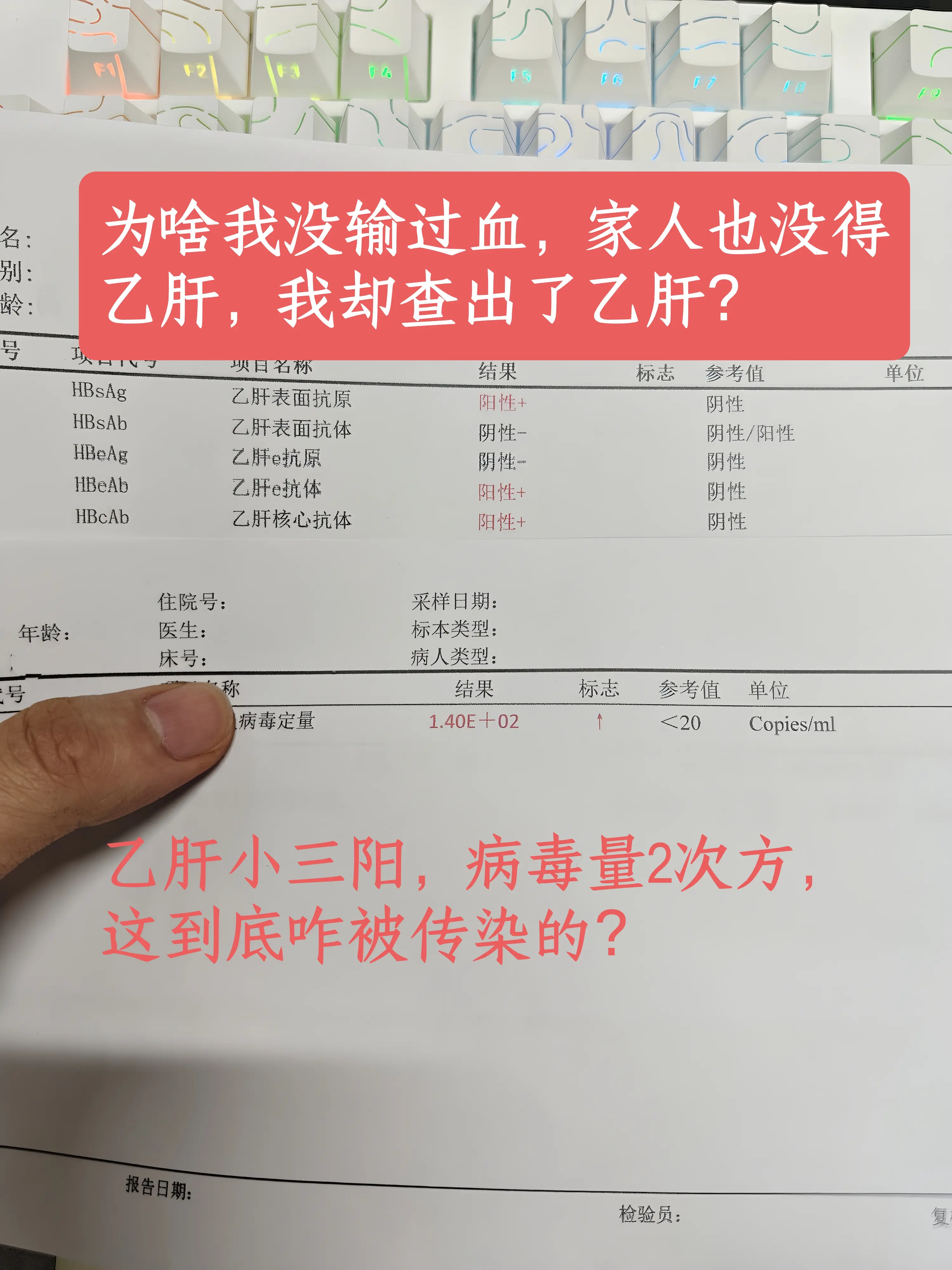 “为啥我没输过血，家人也没乙肝，我却查出了乙肝？这到底怎么得到？据我所...
