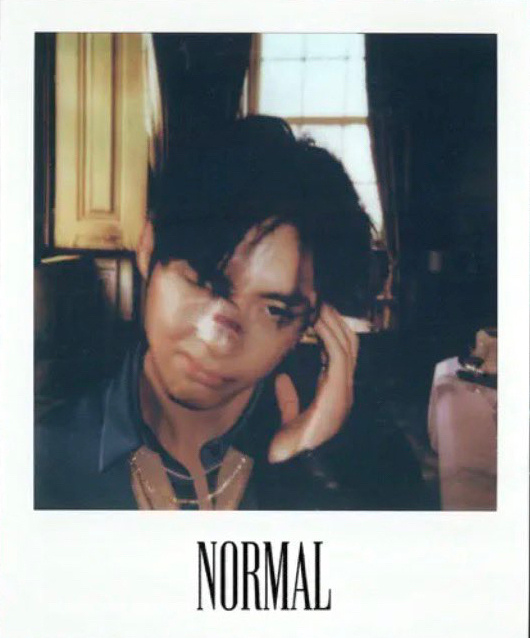 金泰亨 ✨金泰亨kpop永一 金泰亨《Normal》替代版本封面这张好可爱呀