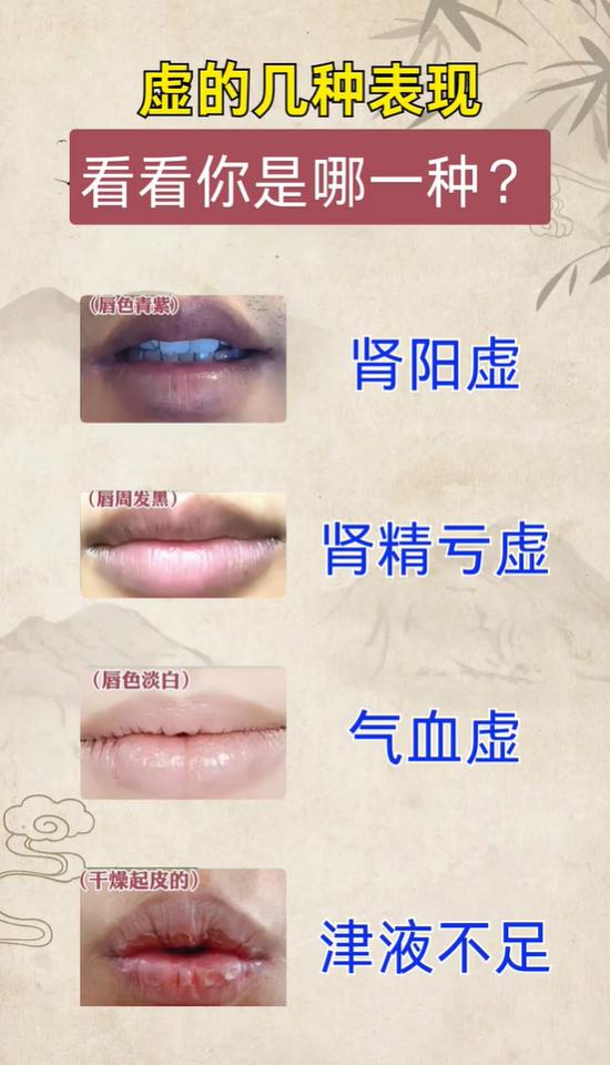 体虚的几种表现，看看你是哪一种？