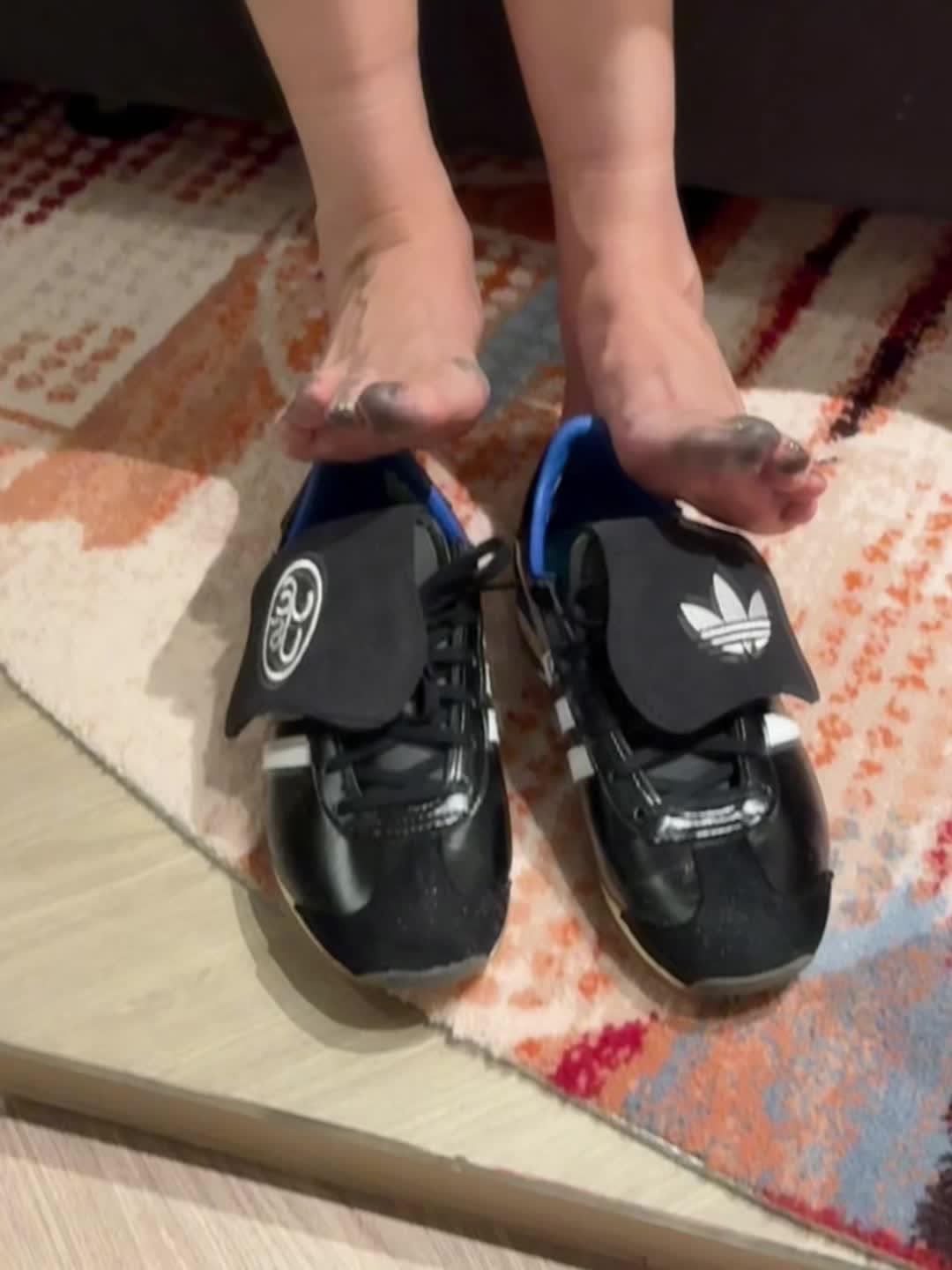 阿迪！你让我在泰国按摩店颜面尽失！ 你！小小阿迪！居然掉色这么严重！脱...