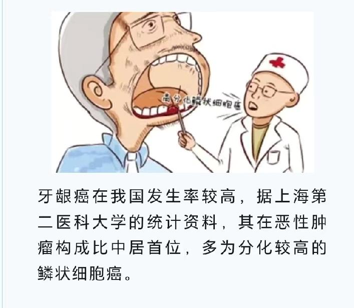 牙癌在医学上常指牙龈癌，是口腔恶性肿瘤。它产生的原因可不少。
不良生活习惯是重要