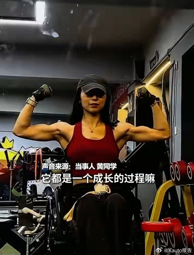 研二女生车祸致高位截瘫练出麒麟臂女生回应车祸高位截瘫仍练出麒麟臂 ​​​“宝剑锋