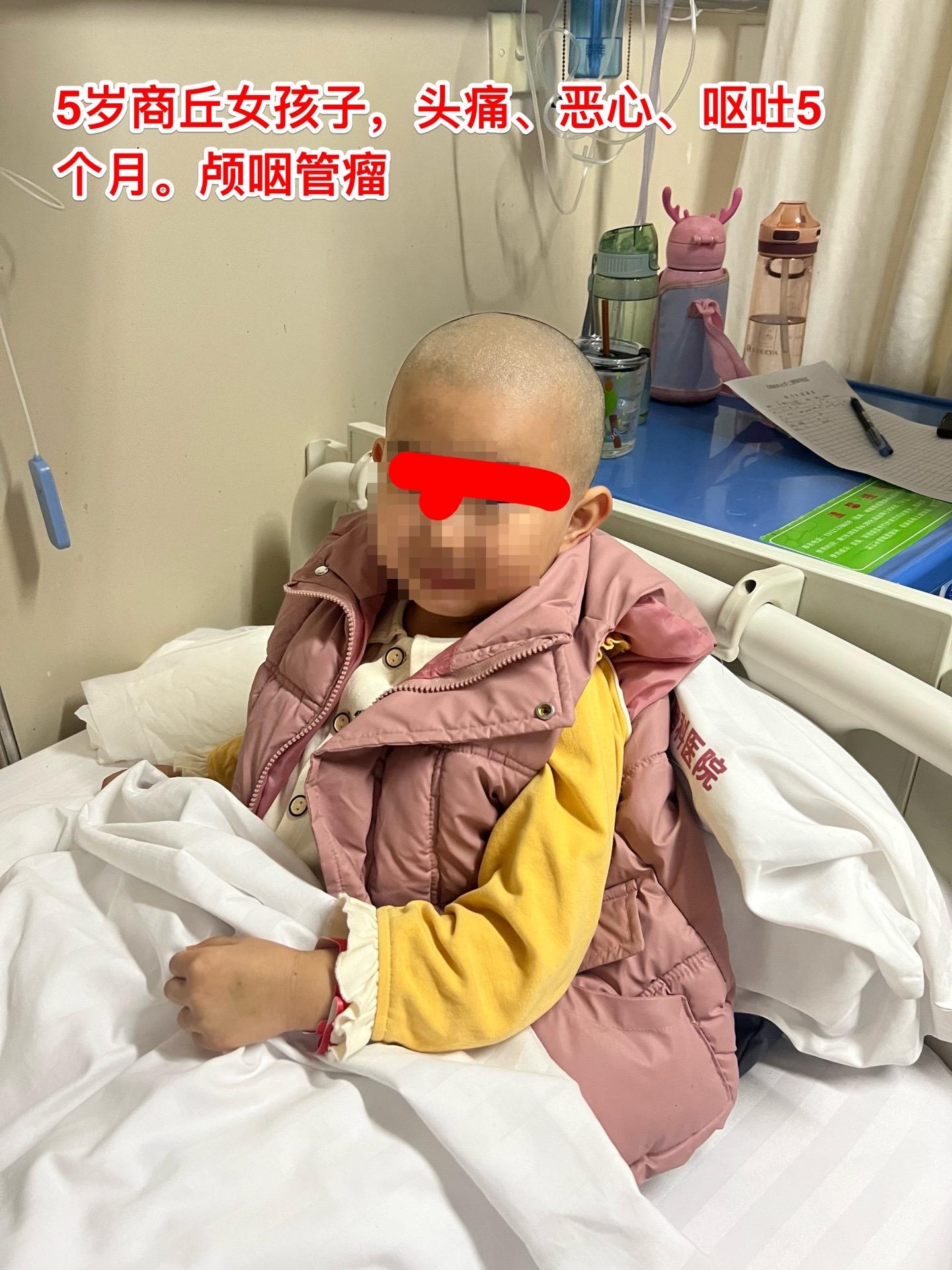 五岁商丘女孩颅咽管瘤像鸡蛋大。女孩子因为反复头痛、呕吐起病，一开始怀疑...
