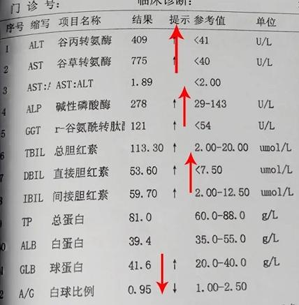 医生最怕：肝病检查报告上出现这7种提示！ ①甲胎蛋白升高大于400，往...