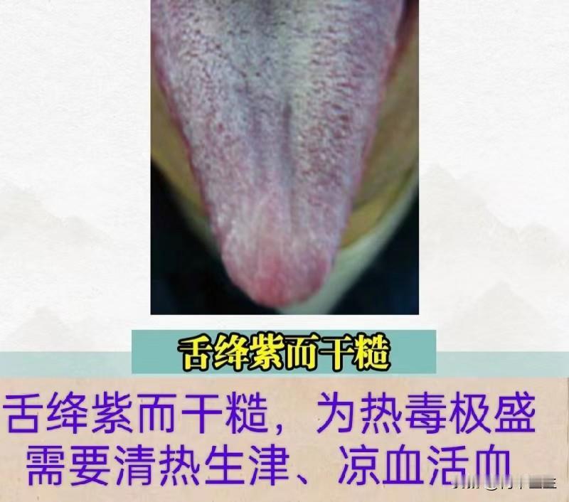 舌头发紫，热、寒、瘀三种舌象辩证分析
#中医##中医舌诊##健康#