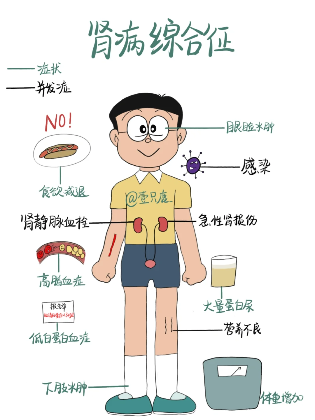 医学生笔记📒｜肾病综合征🧐