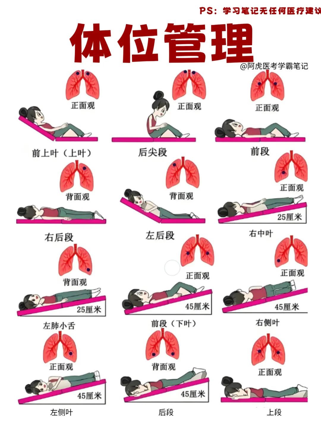 医学生笔记📒｜体位管理👆
