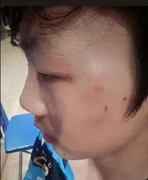 贺睿辰赢了曹彦灏，然后被队友打了。
轻伤，没还手，情绪稳定。
你品品这三个词。一
