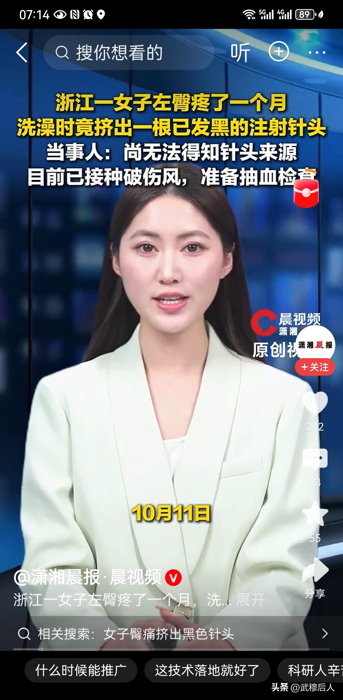 女子左臀疼了一个月洗澡时挤出针头
10月11日，浙江网友小鱼（化名）在社交平台分