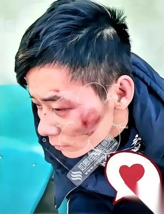大半夜刷到个事

我直接看傻了

换你遇上这事说不定真躲不过。

5月10号凌晨
