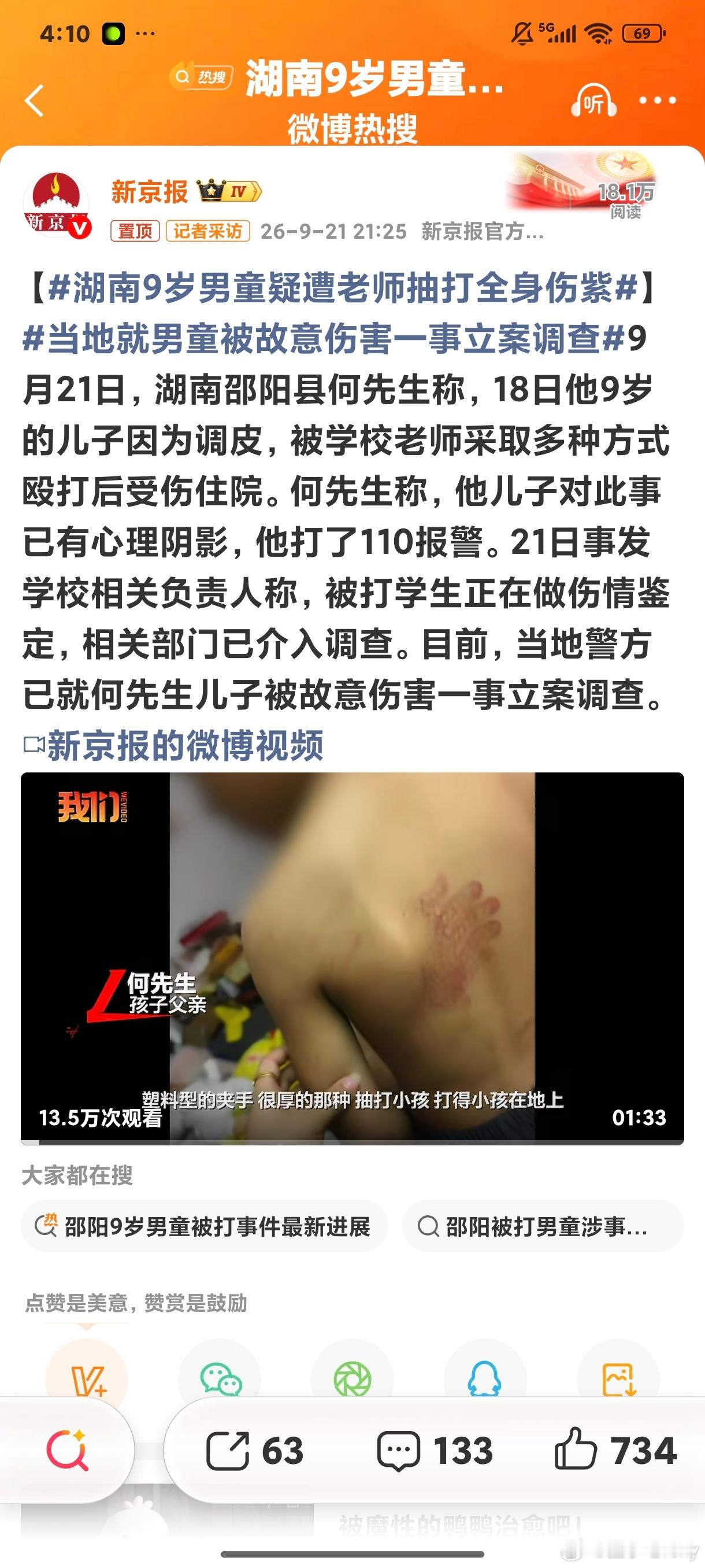 湖南9岁男童疑遭老师抽打全身伤紫这特么已经上升到故意伤害的程度了 还用竹棍抽打其