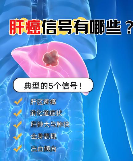 身体不痛不痒竟查出肝癌，这3个信号千万别忽视！
很多肝癌患者确诊时都会说：“平时