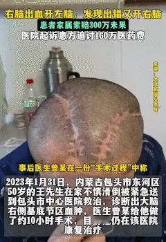 相声段子都不敢写，却发生在现实生活里。
内蒙古包头一男子明明是右脑出血，医生竟给