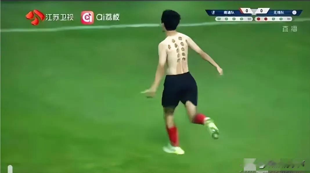 以后不许他们脱球衣，省的看到这样的后背。

居然去拔火罐了！拔火罐就拔火罐，怎么
