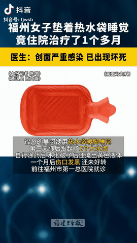 近日，福建福州，一位50多岁的女子睡觉时把热水袋搁脚边取暖，一觉醒来，竟发现脚踝