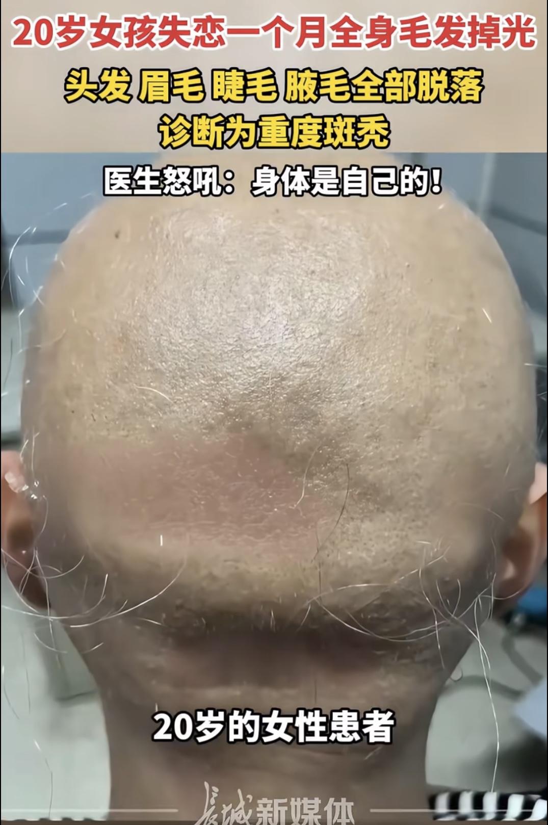 姑娘，咱得把心门开大点！的女‮岁02位那州郑南河

孩，
因被男友断崖式分手，陷