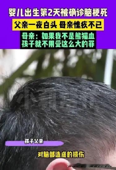 #男婴出生第2天脑梗死父亲一夜白头#男婴出生第2天脑梗死、父亲一夜白头的事件让我