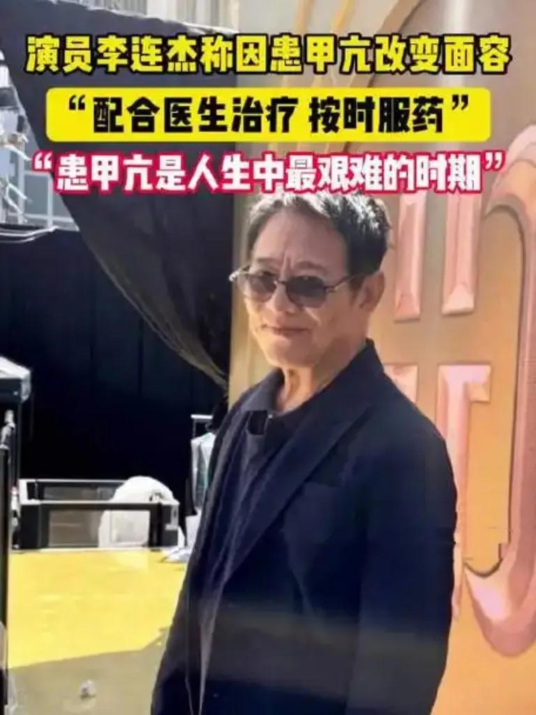 功夫巨星李连杰近照曝光，面容变化令人唏嘘。原来他饱受甲亢折磨多年，眼球突出、脸颊