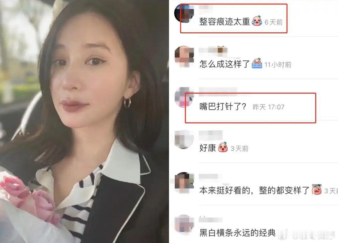 熊乃瑾否认整容  导师在综艺中直接质问演员是否整容，熊乃瑾坦然否认，用实力证明自